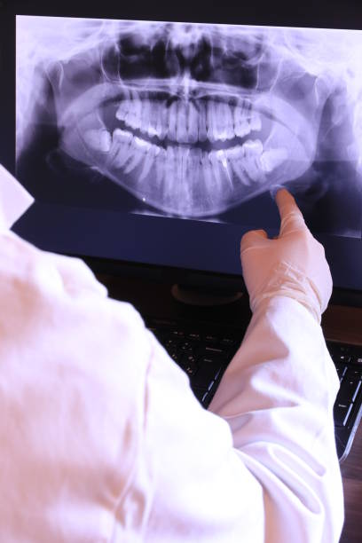 Best Emergency Wisdom Teeth Removal in Independence, LA