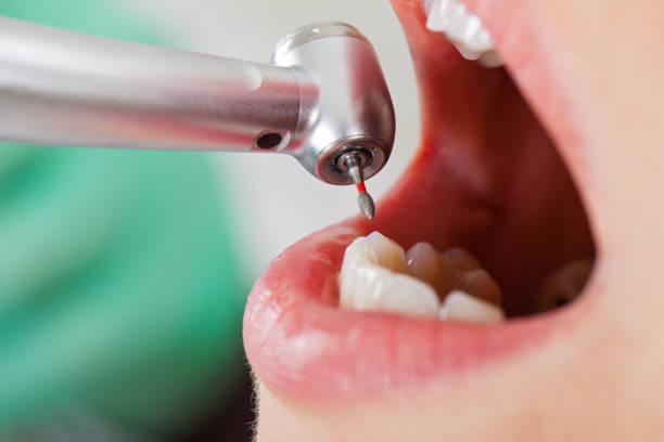 Best Pediatric Emergency Dentist in Independence, LA
